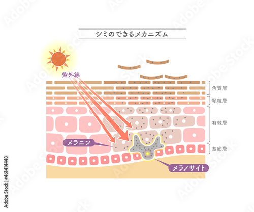 シミのできるメカニズムを示すイラスト。日本語表記。