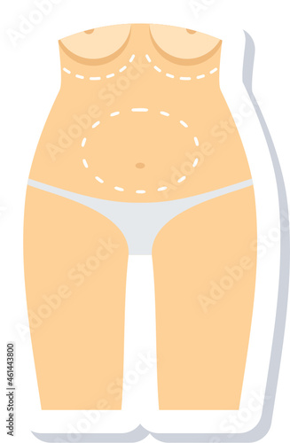 Cosmetic Surgery
