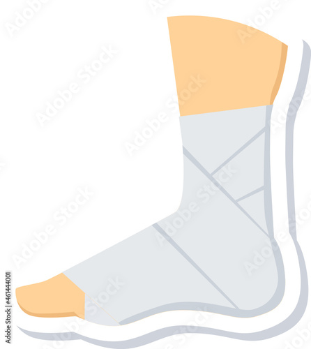 Sprain