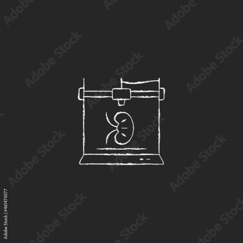 3d printed kidney chalk white icon on dark background. Developing 3d organ structure. Biomedical engineering. Transplantable artificial kidney. Isolated vector chalkboard illustration on black