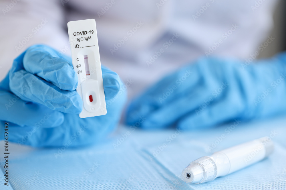 Doctor wearing disposable gloves holds positive PCR test for coronavirus infection