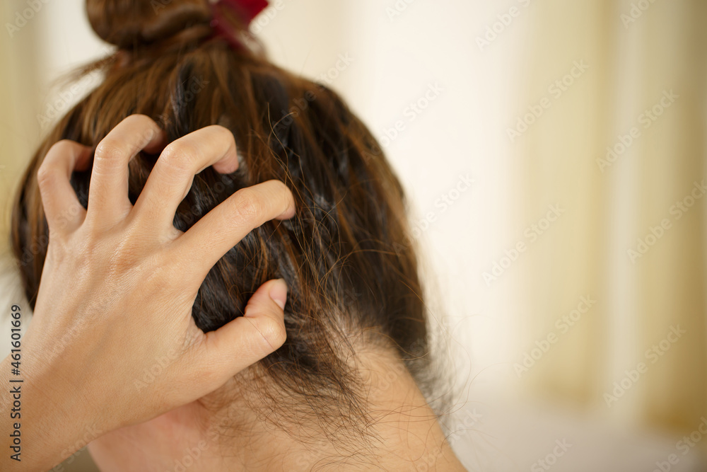 Naklejka premium A woman has problems with hair and scalp,she has dandruff from allergic reactions to shampoos. and hair conditioner