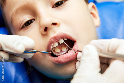 pediatric dentist checks teeth of a little one