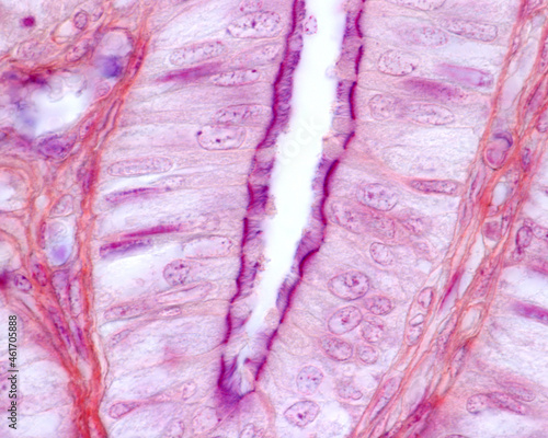 Ciliated columnar epithelium photo