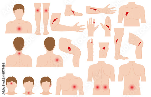 Cartoon physical injured hurt human body parts. Body pain, physical injury scratches, wounds and bone fractures vector illustration set. Human body physical traumas
