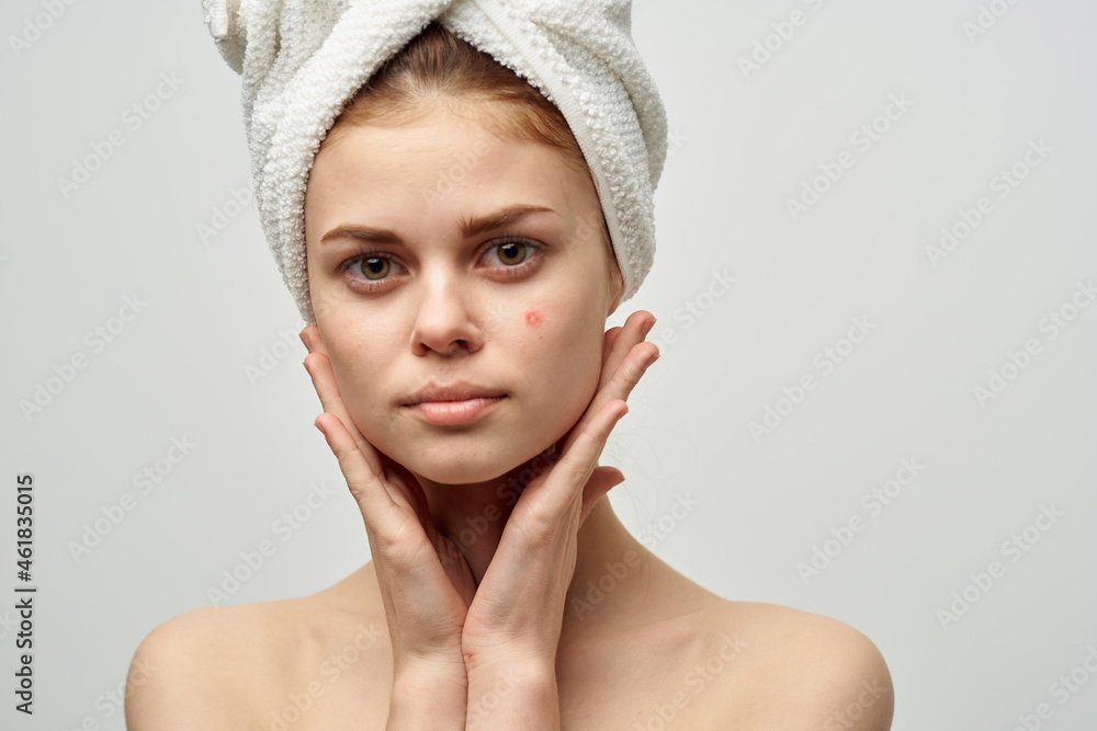 pretty woman with a pimple on the face cosmetology Studio pretty woman with a pimple on the face cosmetology Studio