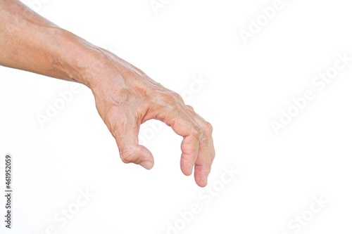 фотографія an old man left hand muscle atrophy between a thumb and index finger caused by t
