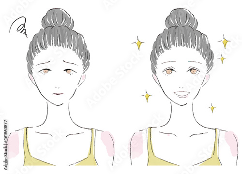 二重の整形をした若い女性のイラスト