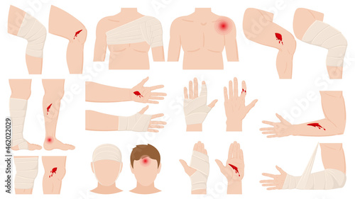 Cartoon physical injury, wound bandage application concept. Open and bandaged human body parts, treated wounds, fractures vector illustration. Human physical injury treatment