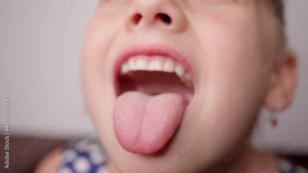 girl opens her mouth wide and pulls out long tongue. child shows his teeth and mouth to dentist. mouth is wide open, tongue is stuck out as far as possible, with clear view of tongue and soft palate Stock-Video | Adobe Stock