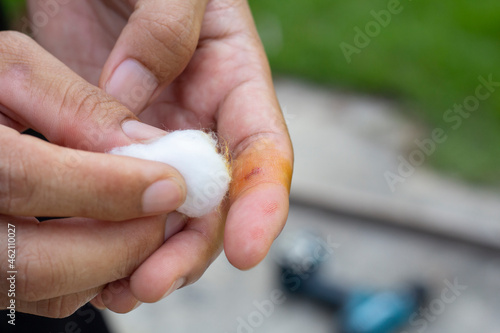 First aid a cotton swab is applied to a fresh wound dressing to the finger due to an accident during work.