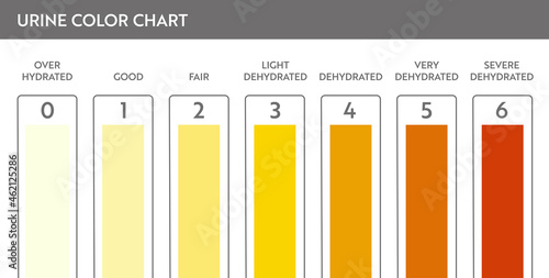 Urine color chart. Pee hydration and dehydration test strip. Vector design for medical education poster.