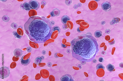 Foto Acute myeloid leukemia (AML) cells in blood flow - isometric view 3d illustratio