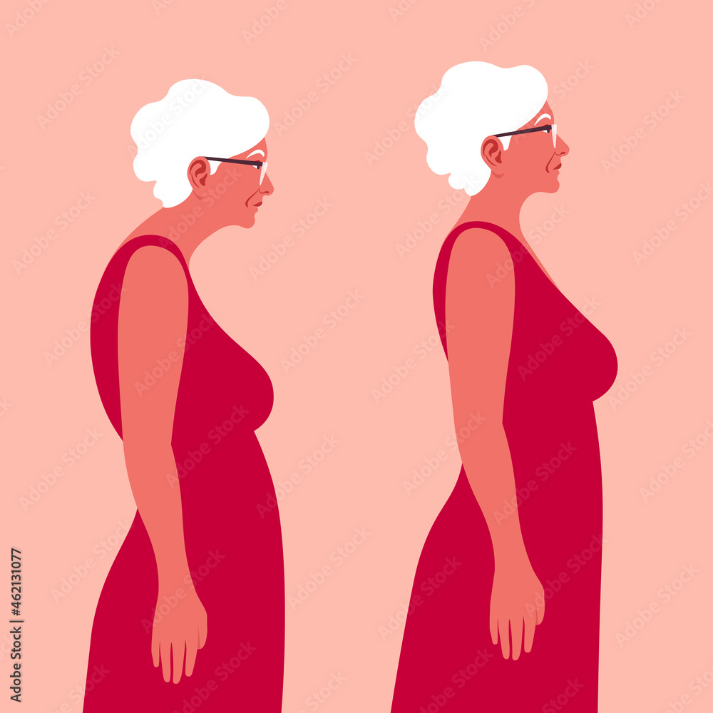 An Elderly woman with a bad posture. Spine. Profile. Kyphosis. Flat vector illustration on red background. Minimalism An Elderly woman with a bad posture. Spine. Profile. Kyphosis. Flat vector illustration on red background. Minimalism