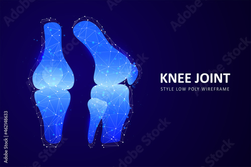 Abstract polygonal knee-joint
