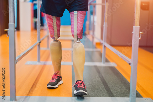Close up of a woman with prosthetic legs using parallel bars 