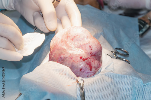 Surgical process. The surgeon removes the tumor. Testicular neoplasm (cancer) in dog photo
