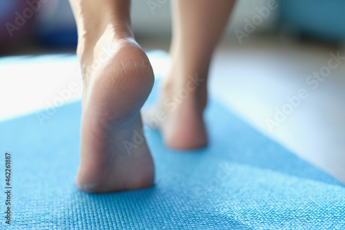Women feet walking on sports mat with dry skin on heels closeup