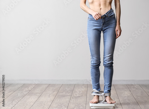 Young woman with anorexia m...