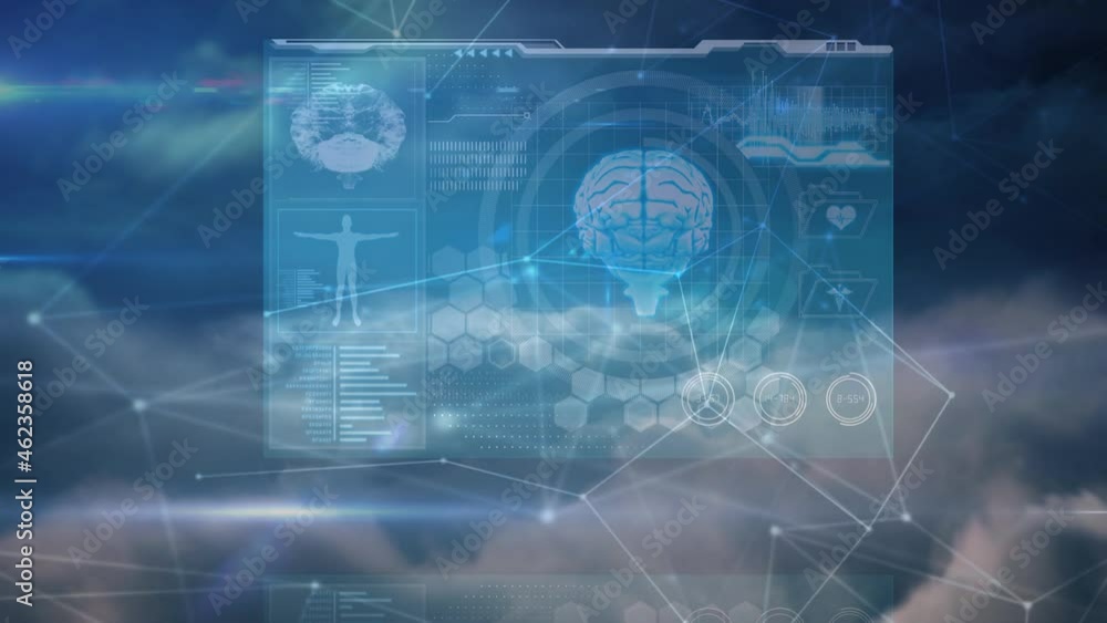 Animation of networks of connections and medical data processing over sky Animation of networks of connections and medical data processing over sky