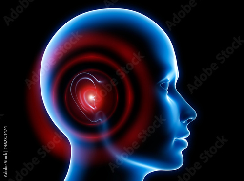 Blue head with ear pain or tinnitus - 3D illustration photo