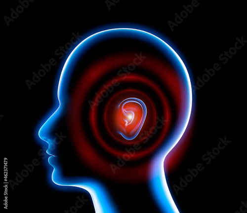 Blue head with ear pain or tinnitus - 3D illustration photo