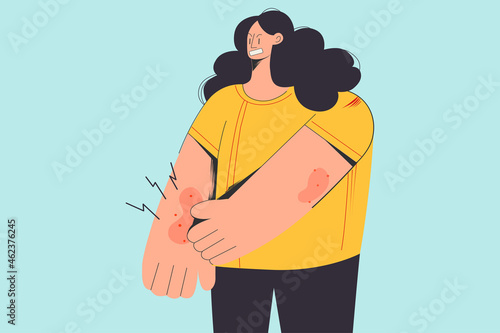 Unhappy woman scratch itch arm suffer from seasonal allergy. Distressed upset girl struggle with psoriasis or atopic dermatitis, have skin problems. Skincare, healthcare. Flat vector illustration.  photo
