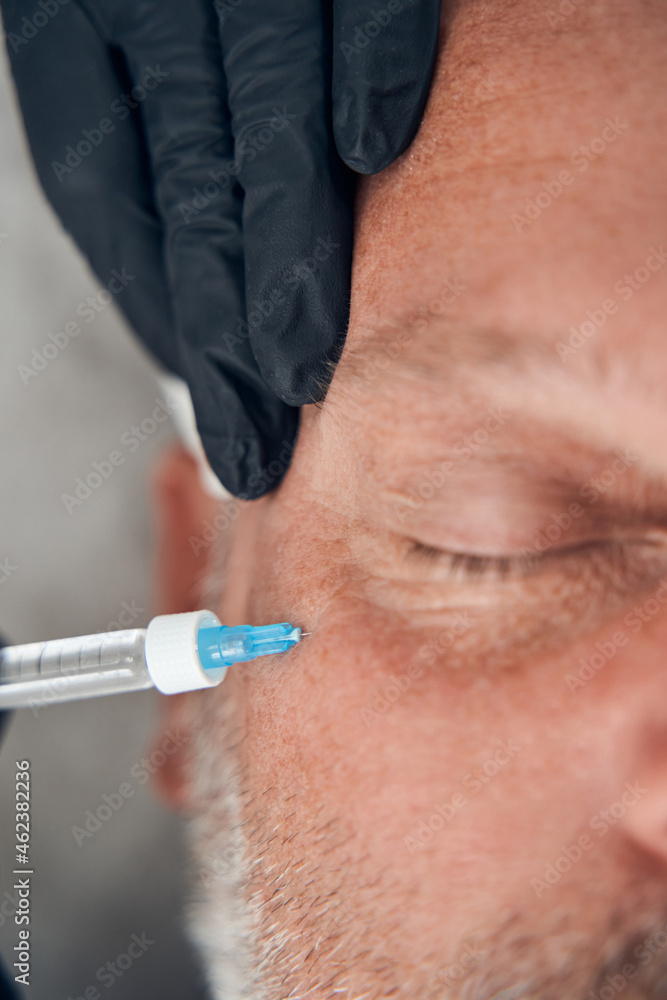 Doctor beautician hands making injection into man face Doctor beautician hands making injection into man face