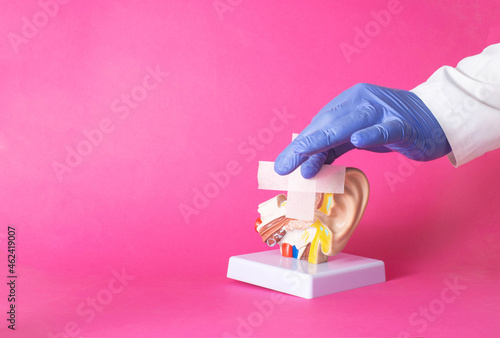 The doctor glues a medical plaster to the mock up of the human ear, pink background. Concept for the treatment of mycosis of the ears and tinnitus, copy space for text photo