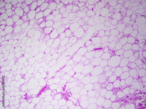 Microscope histology image of adipose tissue of the hypodermis (100x) photo