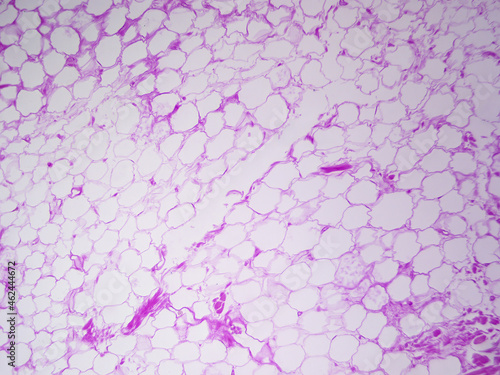 Εκτύπωση καμβά Microscope histology image of adipose tissue of the hypodermis (100x)