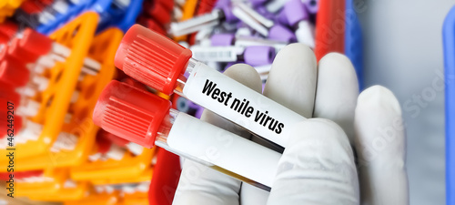 Blood sample for West Nile virus(WNV) testing, mosquito-borne disease in the continental US