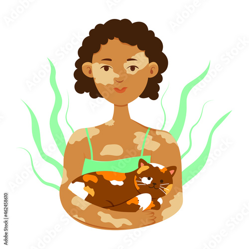 Dark-skinned cute girl with vitiligo on the skin and a cat in her hands