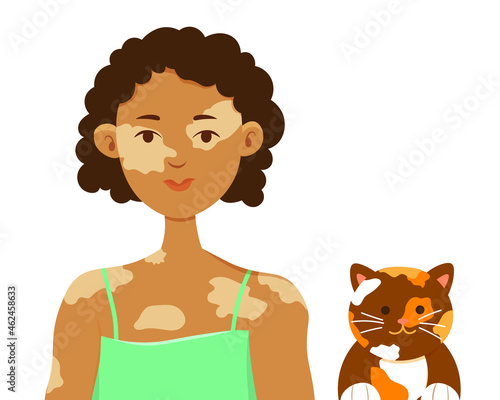 Dark-skinned girl with vitiligo on the skin and a spotted cat