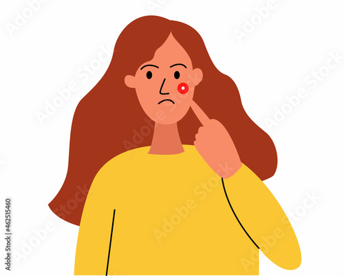 a teenage girl with a pimple on her cheek. The girl points to a pimple, a pimple on her face. Problematic skin, self-doubt. Vector illustration