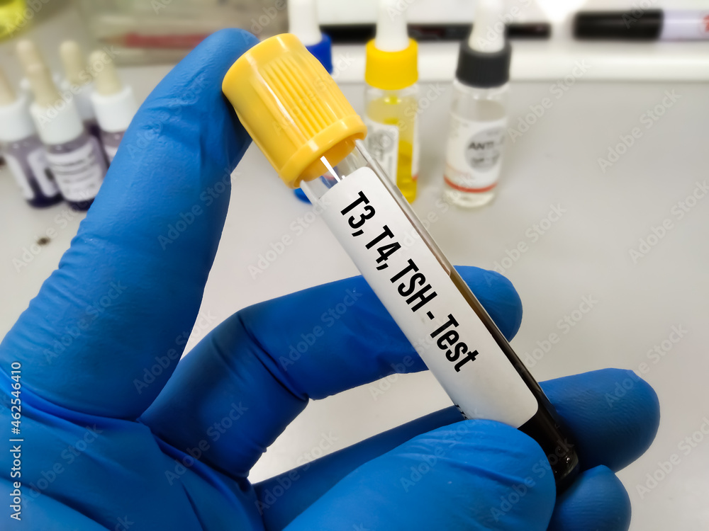 Blood sample for thyroid hormone test for T3, T4, TSH with laboratory ...