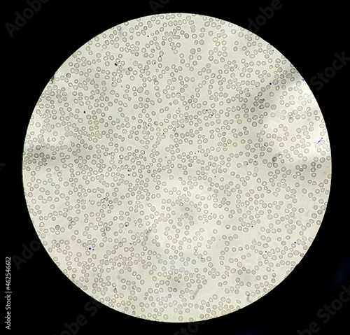 Blood smear leishman stained Microscopic 100x show leucocytopenia and thrombocytopenia at medical laboratory. photo