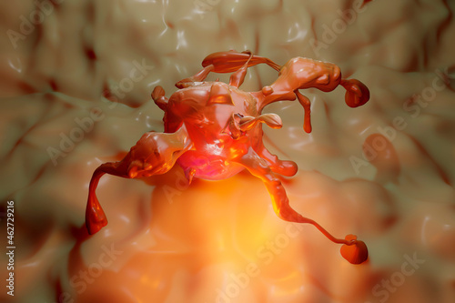 Three dimensional render ofÔøΩmetastasis ofÔøΩcancerous tumor photo