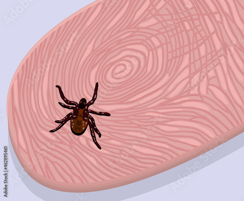 Vector illustration of mite on the finger. Light lilac background.