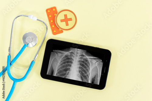 Tablet with x-ray and stethoscope, on yellow background. Top view.