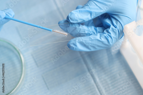 Quadro su tela Taking vaginal smear from women on glass closeup