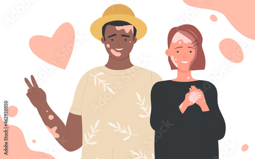 People with vitiligo vector illustration. Cartoon portraits of positive man woman characters standing together. Body positive, self love and depigmentation disease, world vitiligo day concept