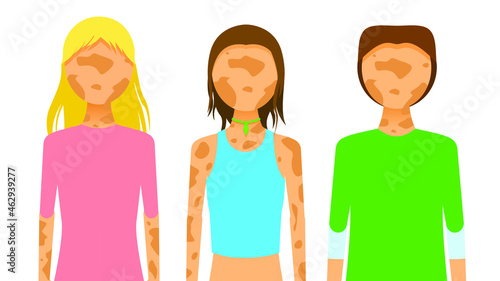 Set Flat Collection Girl Woman Man Character Stains Vitiligo Depigmentation Disease Vector Design Style Concept People Are Equal