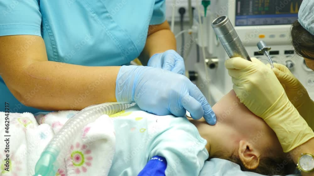 Tracheal intubation on kid patient in resuscitation. Anesthesiologist doctor insets endotracheal