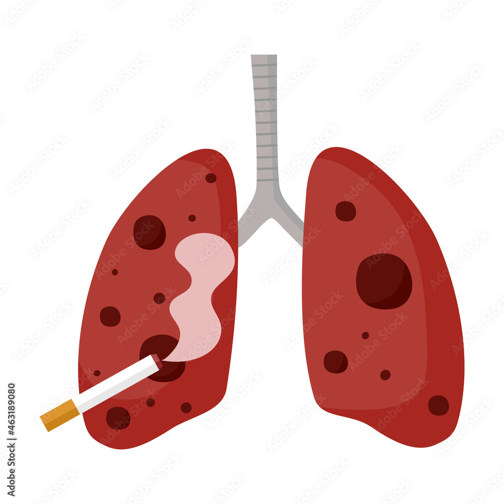 Damaged lung from smoking in flat design on white background. Risk of cigarette smoking. Damaged lung from smoking in flat design on white background. Risk of cigarette smoking.
