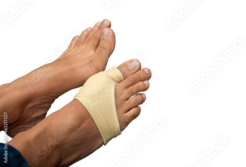 A middle age woman feet have bunion bent toe problem wearing foot support on treatment for bent toe problem and help to protect the toe from discomfort, pressure and inflammation caused by bunion.  photo