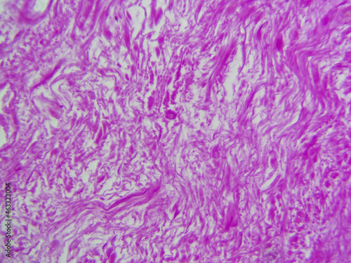 Histology microscope image of dense irregular connective tissue proper in dermis (400x) photo