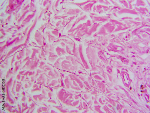 Histology microscope image of dense irregular connective tissue proper in dermis (400x) photo