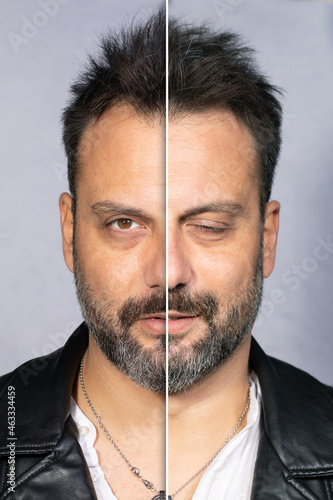 Принти на полотні Effects before and after a facial paralysis