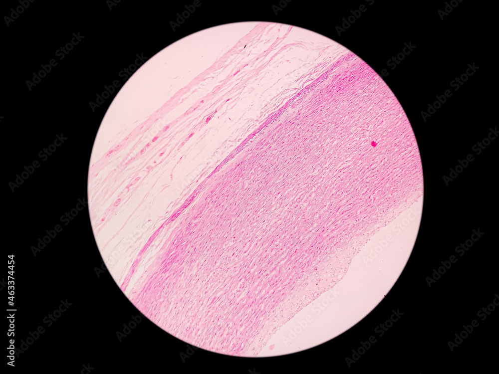 Histology of large sized artery : educational microscopic (LM) image